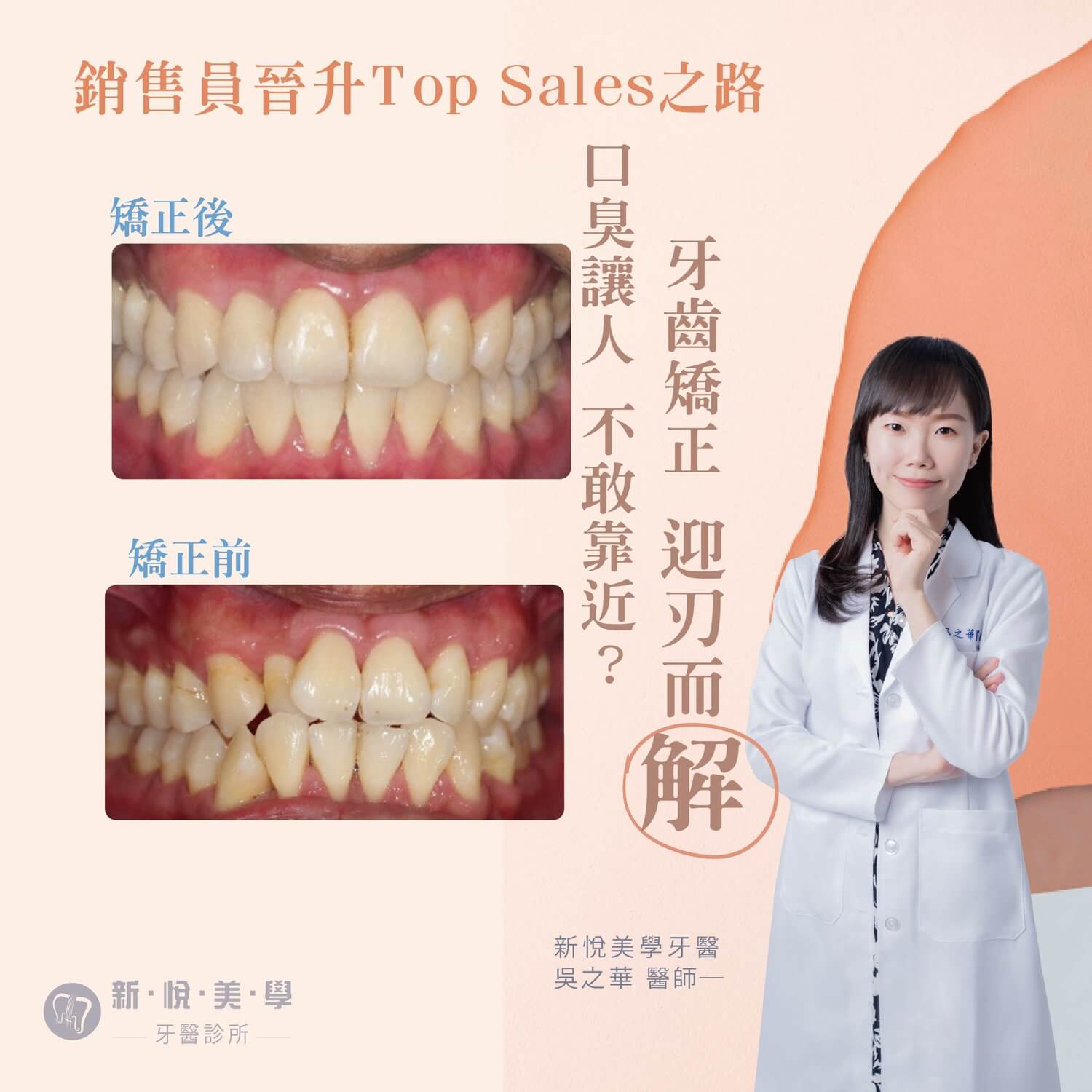 新悅美學牙醫診所的案例分享圖片